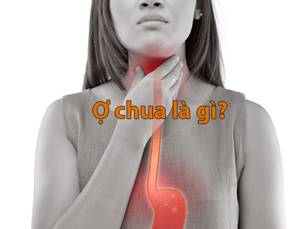 Ợ chua