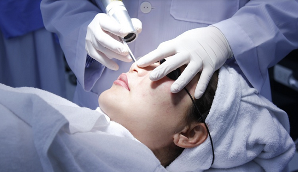 phương pháp laser