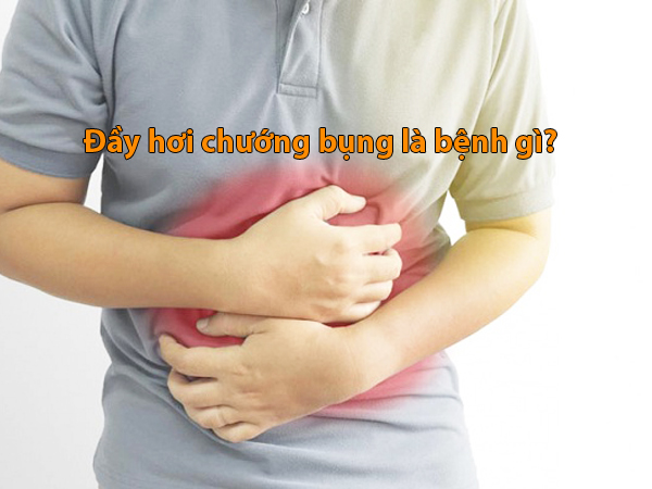 Đầy hơi chướng bụng