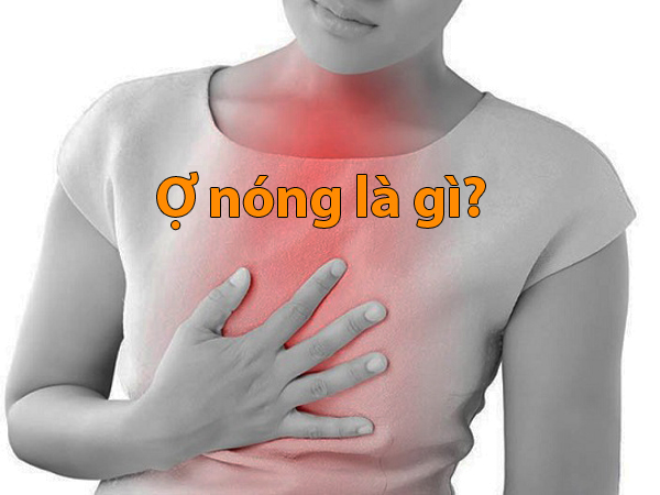 Ợ nóng