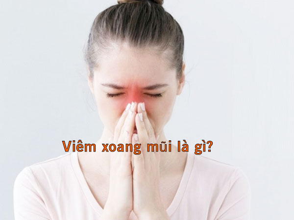 viêm xoang mũi