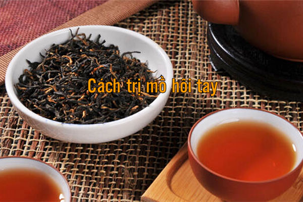 giảm tiết mồ hôi tay