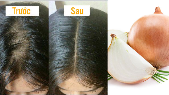 cách kích thích mọc tóc tại nhà