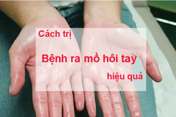 cách trị mồ hôi tay