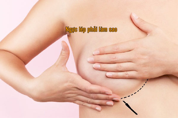cải thiện vòng 1 lép