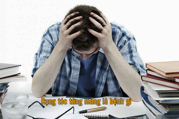 nguyên nhân rụng tóc từng mảng