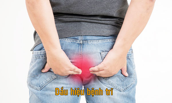 dấu hiệu bệnh trĩ