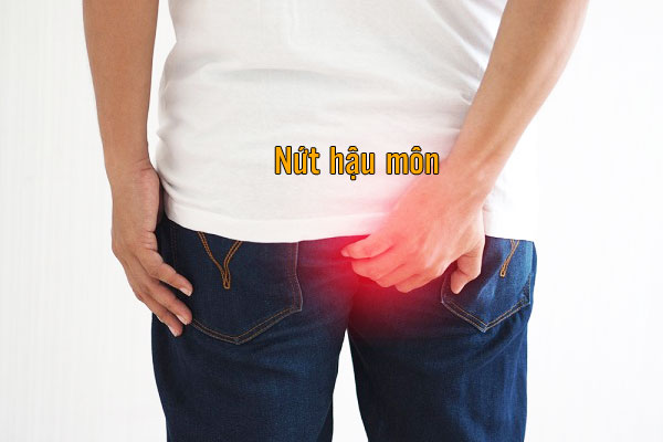 Nứt hậu môn
