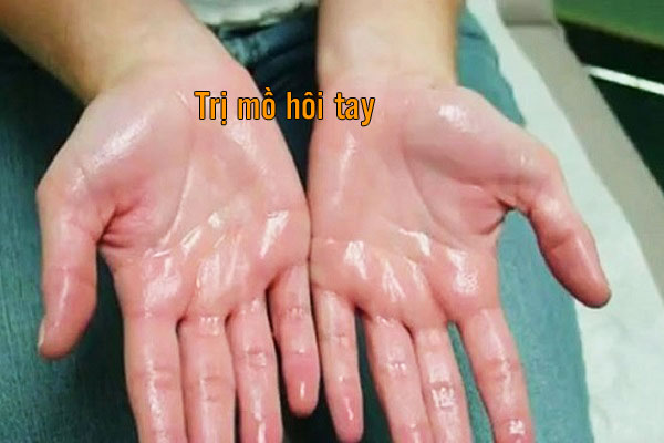 mồ hôi tay