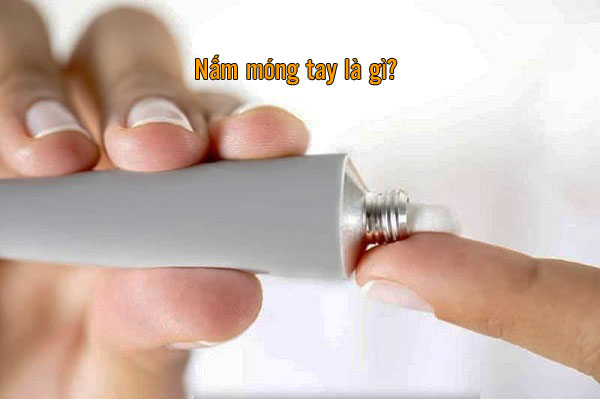 điều trị nấm móng tay