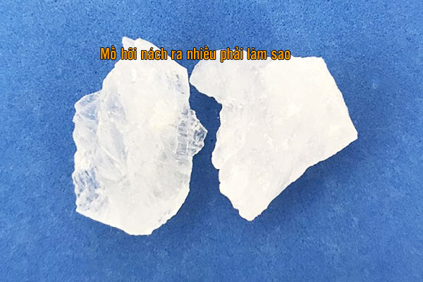 trị mồ hôi nách