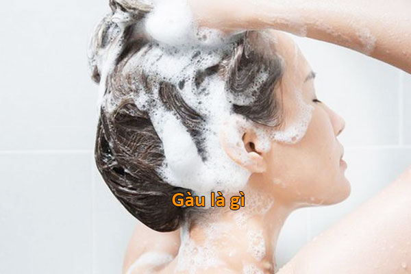 cách phòng ngừa gàu