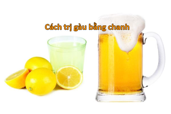 trị gàu bằng bia và chanh