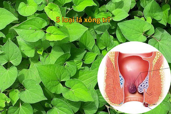 xông lá lốt chữa trĩ