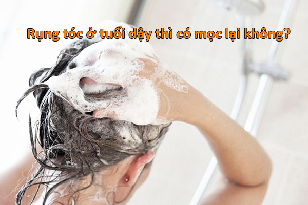 làm sao để hết rụng tóc ở tuổi dậy thì