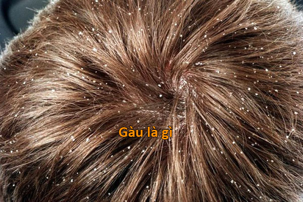 gàu là gì