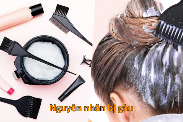 nguyên nhân bị gàu