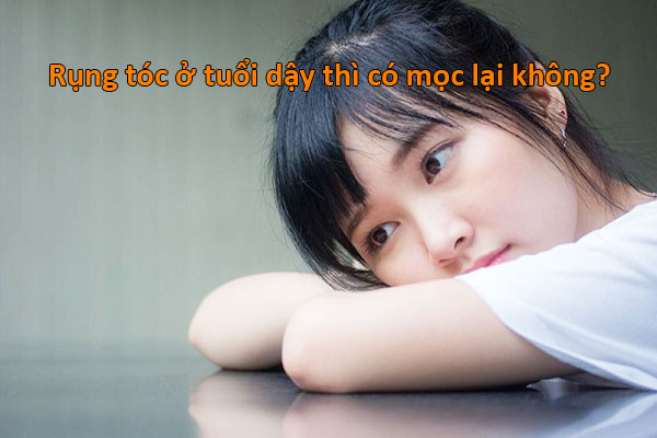 rụng tóc ở tuổi dậy thì có mọc lại không
