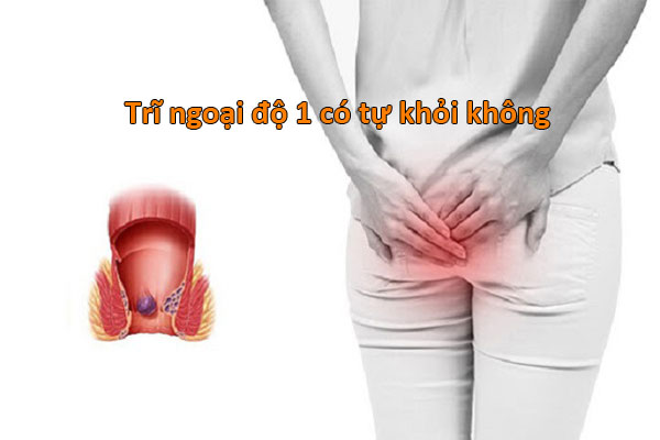 trĩ ngoại độ 1 có tự khỏi không