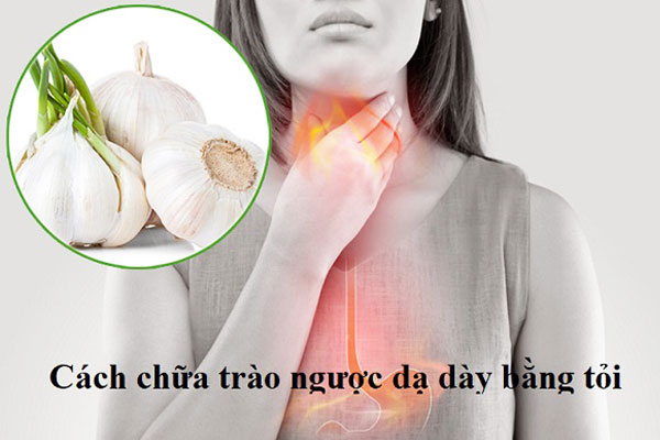 cách chữa trào ngược dạ dày bằng tỏi