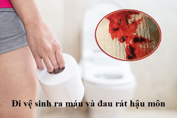 đi vệ sinh ra máu và đau rát hậu môn