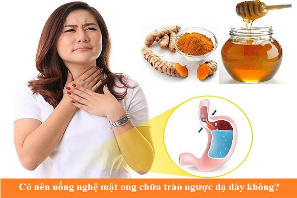 trào ngược dạ dày uống nghệ và mật ong