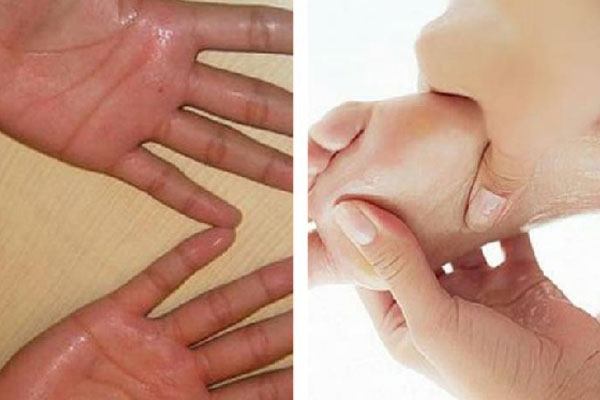 cách trị mồ hôi tay chân