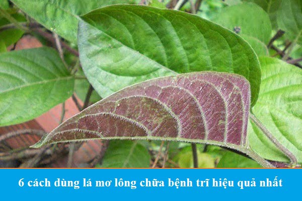 lá mơ lông chữa bệnh trĩ