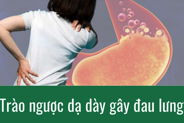 trào ngược dạ dày gây đau lưng