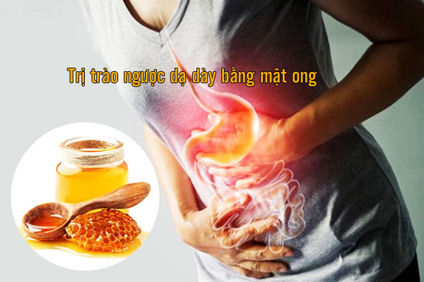trị trào ngược dạ dày bằng mật ong
