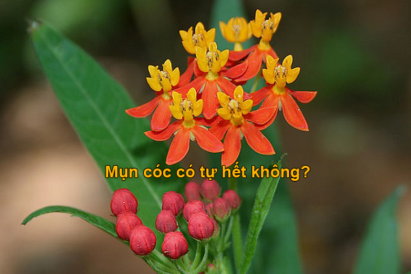 Cây bông tai trị mụn cóc