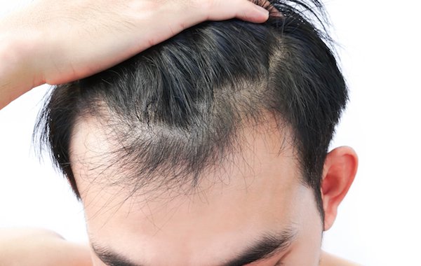 Tóc bắt đầu mọc dài