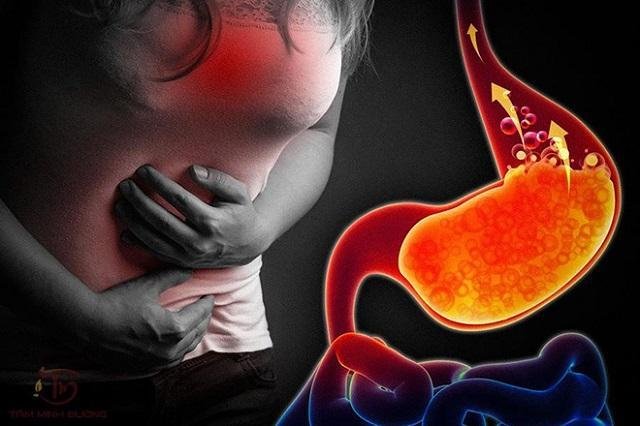 Trào ngược dạ dày gây buồn nôn