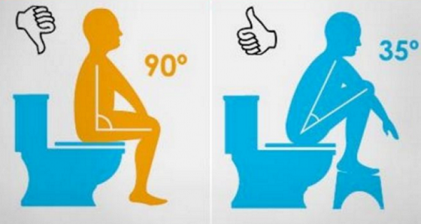 cách đi vệ sinh khi bị trĩ