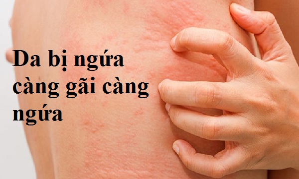 Da bị ngứa càng gãi càng ngứa