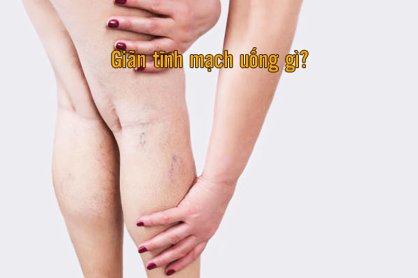 Giãn tĩnh mạch uống gì