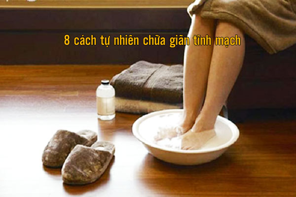 8 cách tự nhiên chữa giãn tĩnh mạch