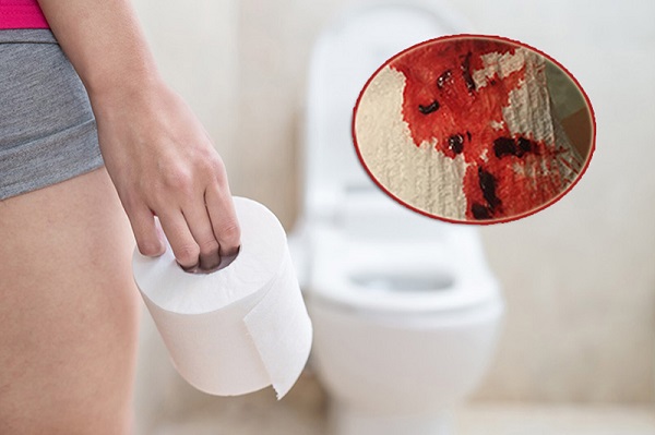 Đi cầu ra máu tươi đau rát hậu môn