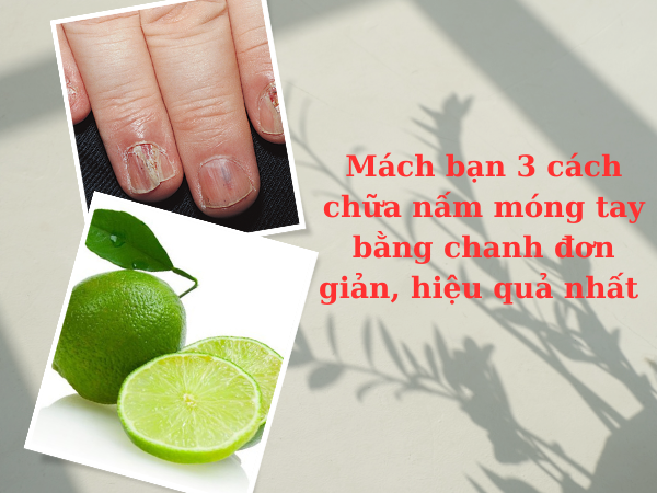 Chữa nấm móng tay bằng chanh