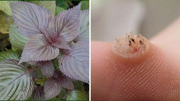 Trị mụn cóc bằng lá tía tô