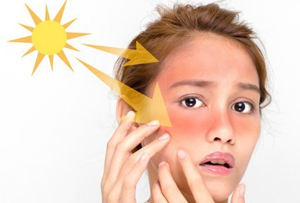 Da bị ngứa khi trời nóng