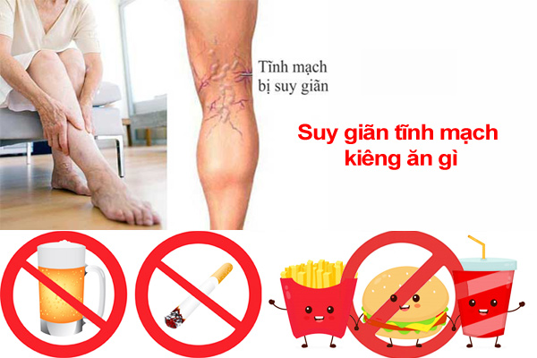 Bệnh nhân suy giãn tĩnh mạch kiêng ăn gì