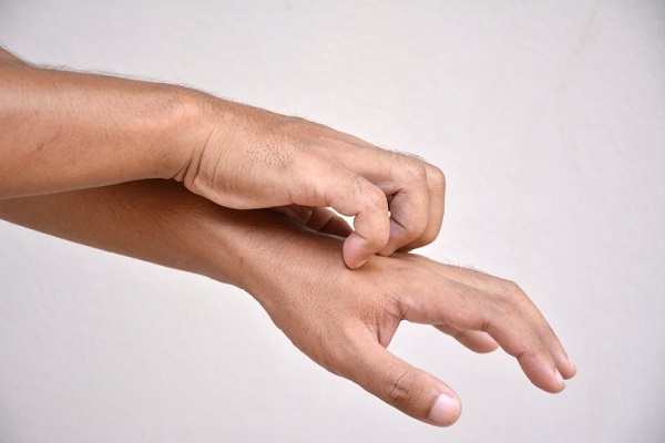 Bị ngứa tay chân không rõ nguyên nhân, phải làm sao?