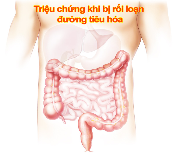 Triệu chứng thường thấy khi bị rối loạn đường tiêu hóa