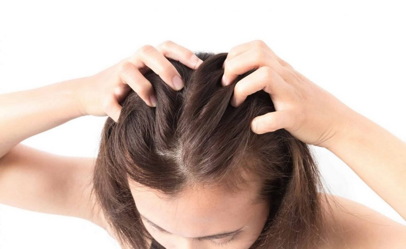 rụng tóc sau sinh