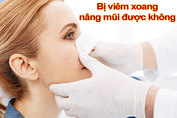 Bị viêm xoang có nâng mũi được không?