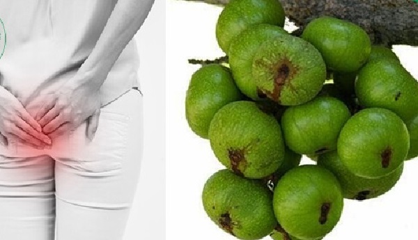 Xông hơi bằng quả sung chữa bệnh trĩ